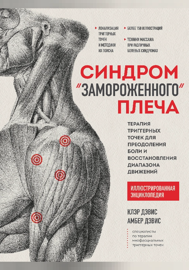 Синдром «замороженного» плеча. Терапия триггерных точек для преодоления боли и восстановления диапазона движений. Обложка